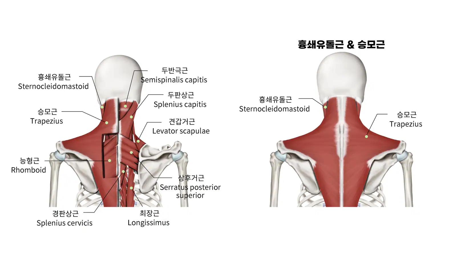 머리 및 목 혈관 해부도, 상쾌한의원 의료진이 사용하는 건강 진단 이미지.